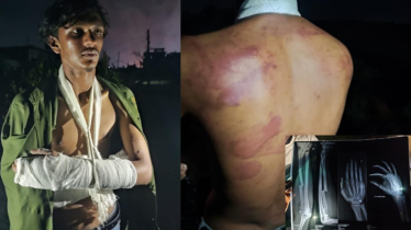 রূপগঞ্জে ছাত্রদল নেতার  মাস্তানী, যুবককে কুপিয়ে জখম